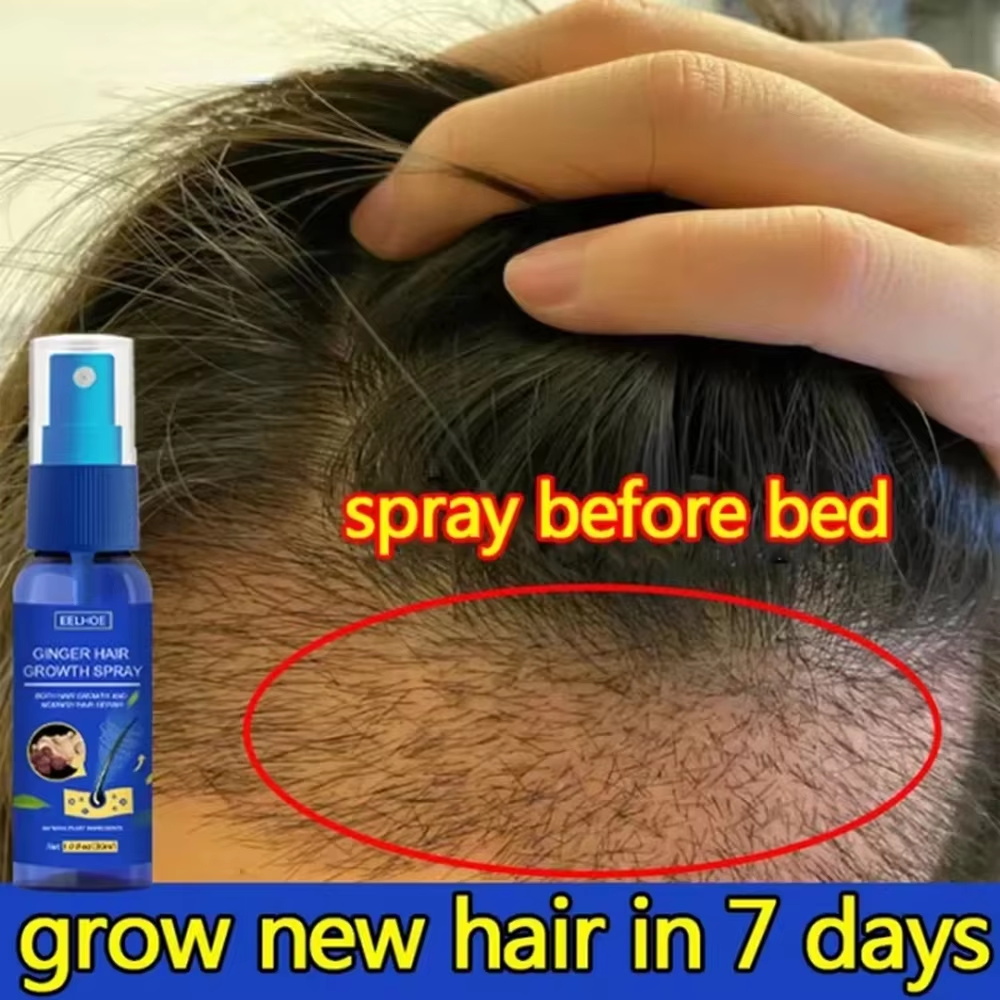 Hair Care Products - Fast Ginger Hair Growth Spray Roots