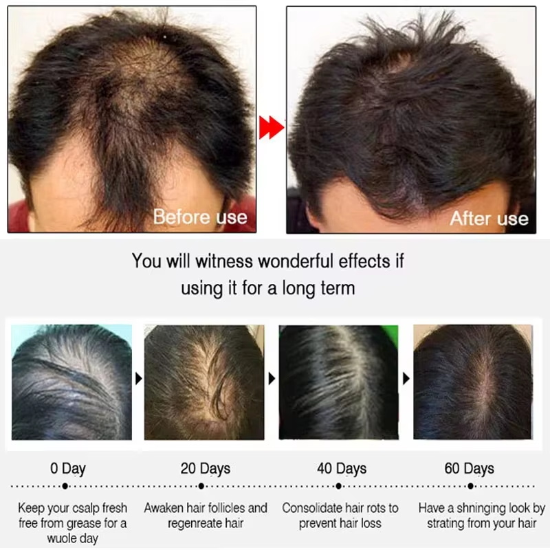 Fast Ginger Hair Growth Spray  - огляд і ціна Hair Care Products