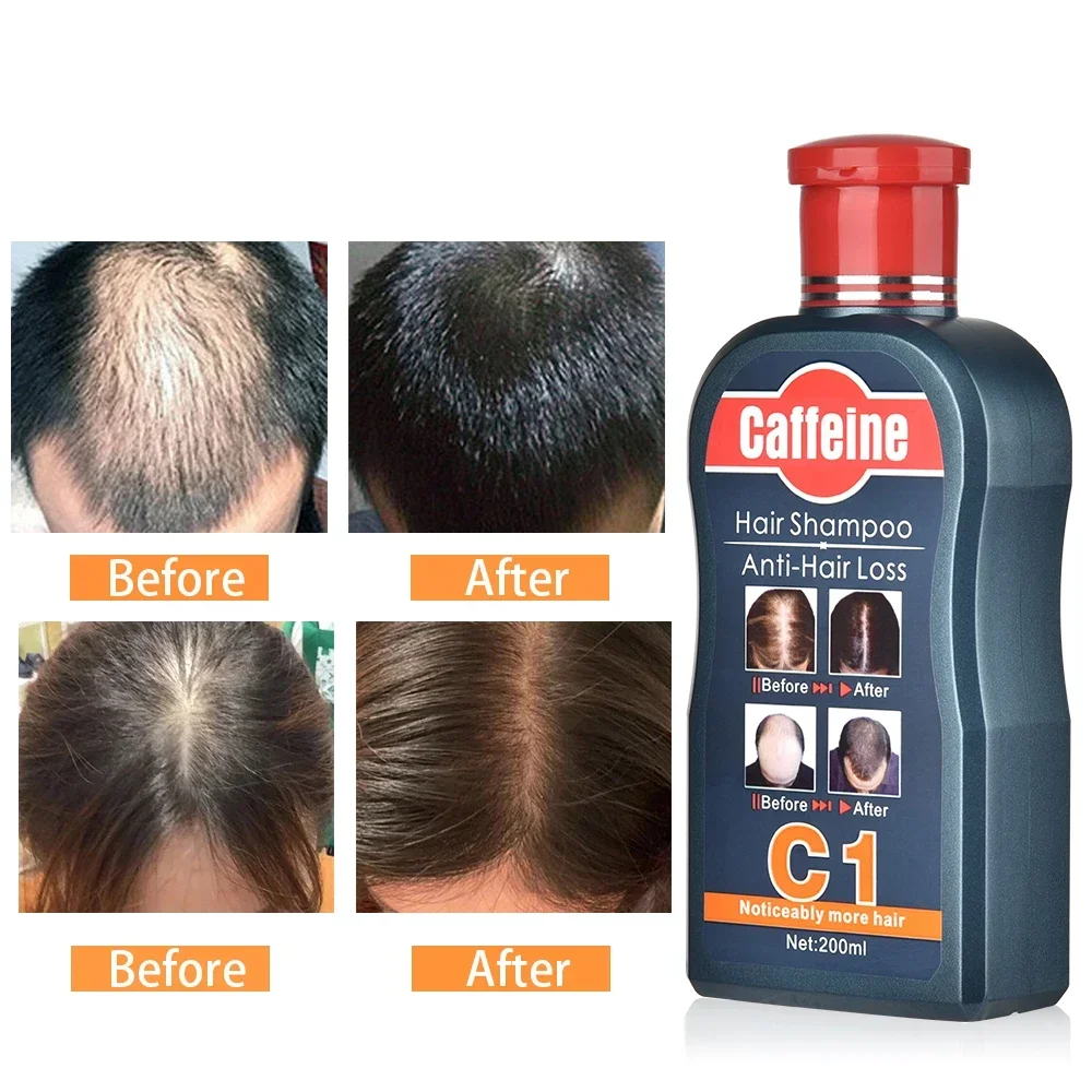 Men Shampoo For Hair Growth Na - огляд і ціна Hair Care Korean Products